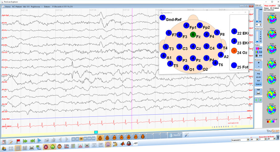 TruScan Neurofeedback Explorer